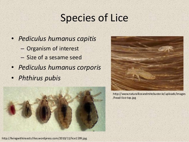 Adult case of lice Guy dominates girl anal